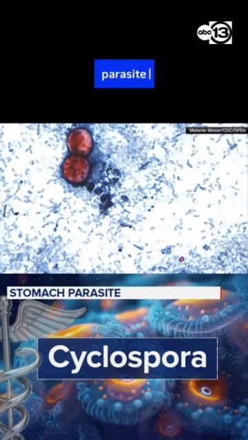 Tips to stay safe amid rising cases of stomach parasite cyclospora