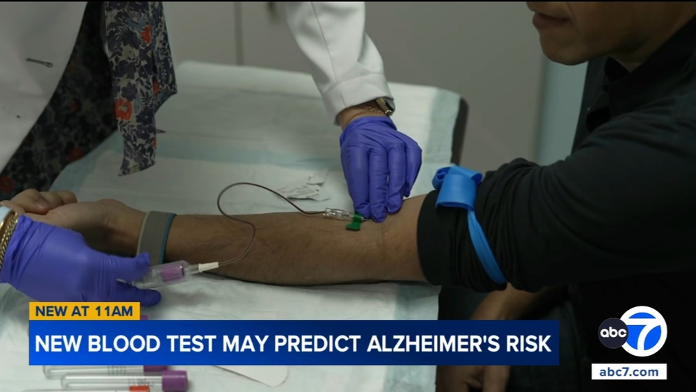 A blood test may predict the start of Alzheimer's symptoms