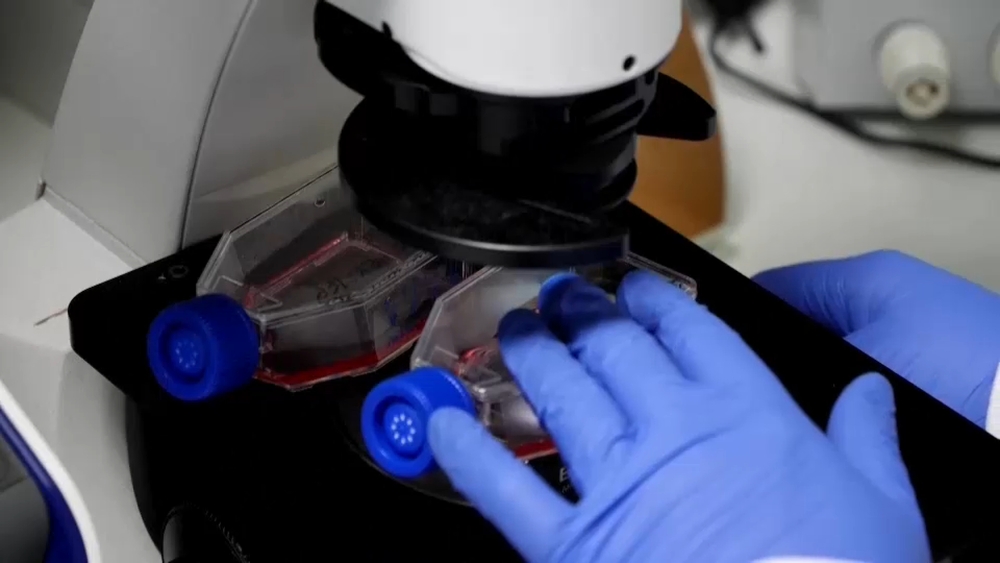 Study shows a blood test can help identify healthy people at high risk for Alzheimer's disease