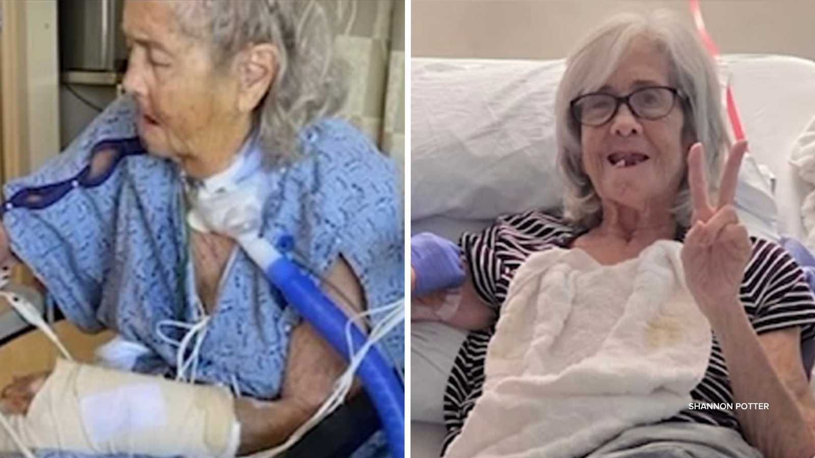 Seal Beach woman struck by teen on e-motorcycle advocates for safety and accountability Seal Beach woman struck by teen on e-motorcycle advocates for safety and accountability