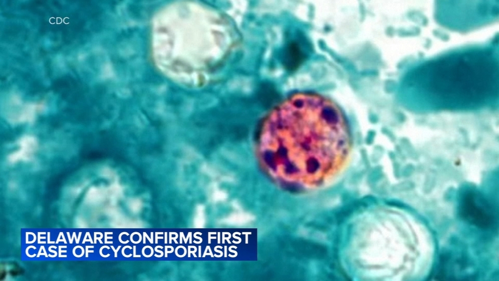Delaware confirms first case of cyclosporiasis