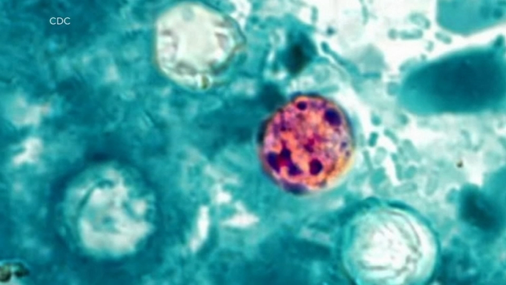 Illinois included in multi-state outbreak of cyclosporiasis, parasite causing stomach issues