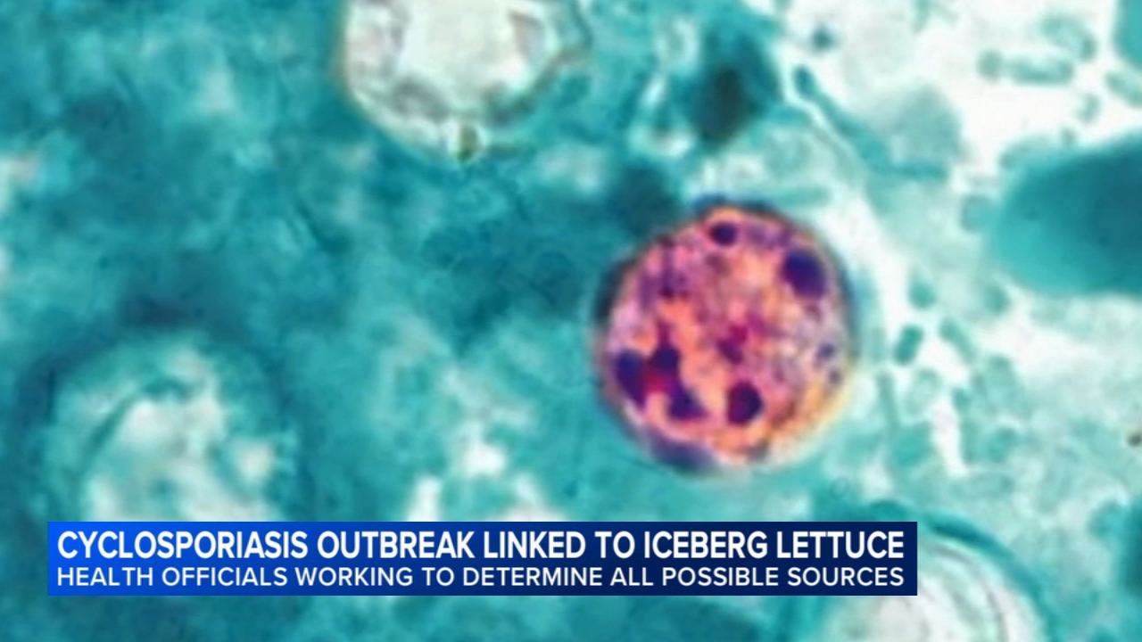 CDC expands cyclosporiasis outbreak to 9 states