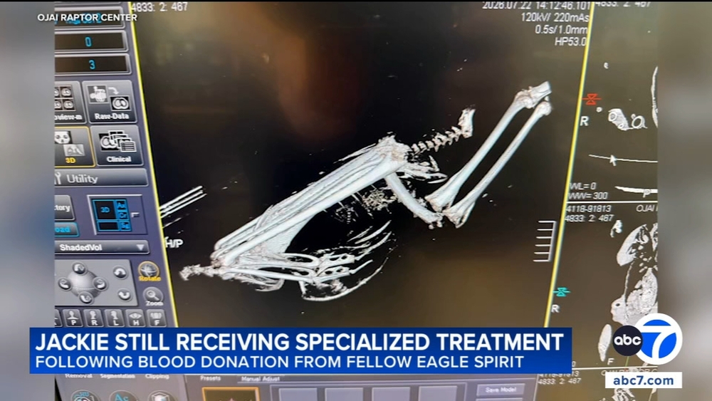 Jackie still receiving specialized care after blood transfusion