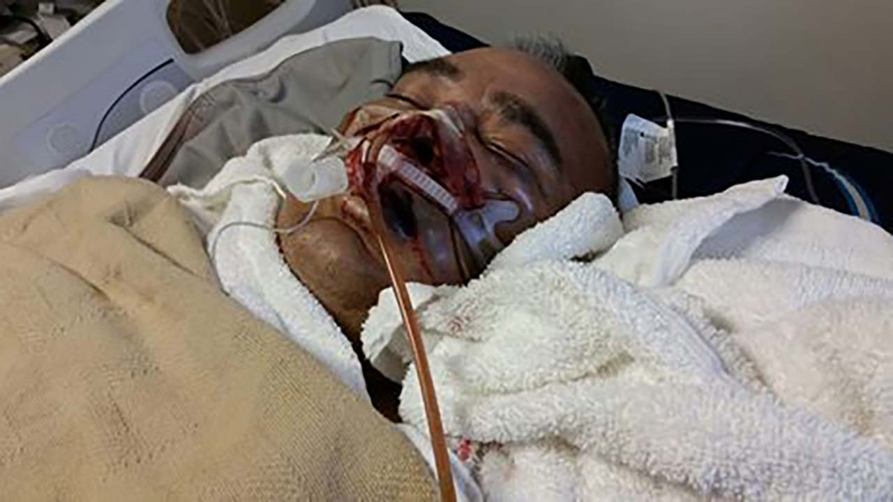 Family claims deputies responsible for man's death