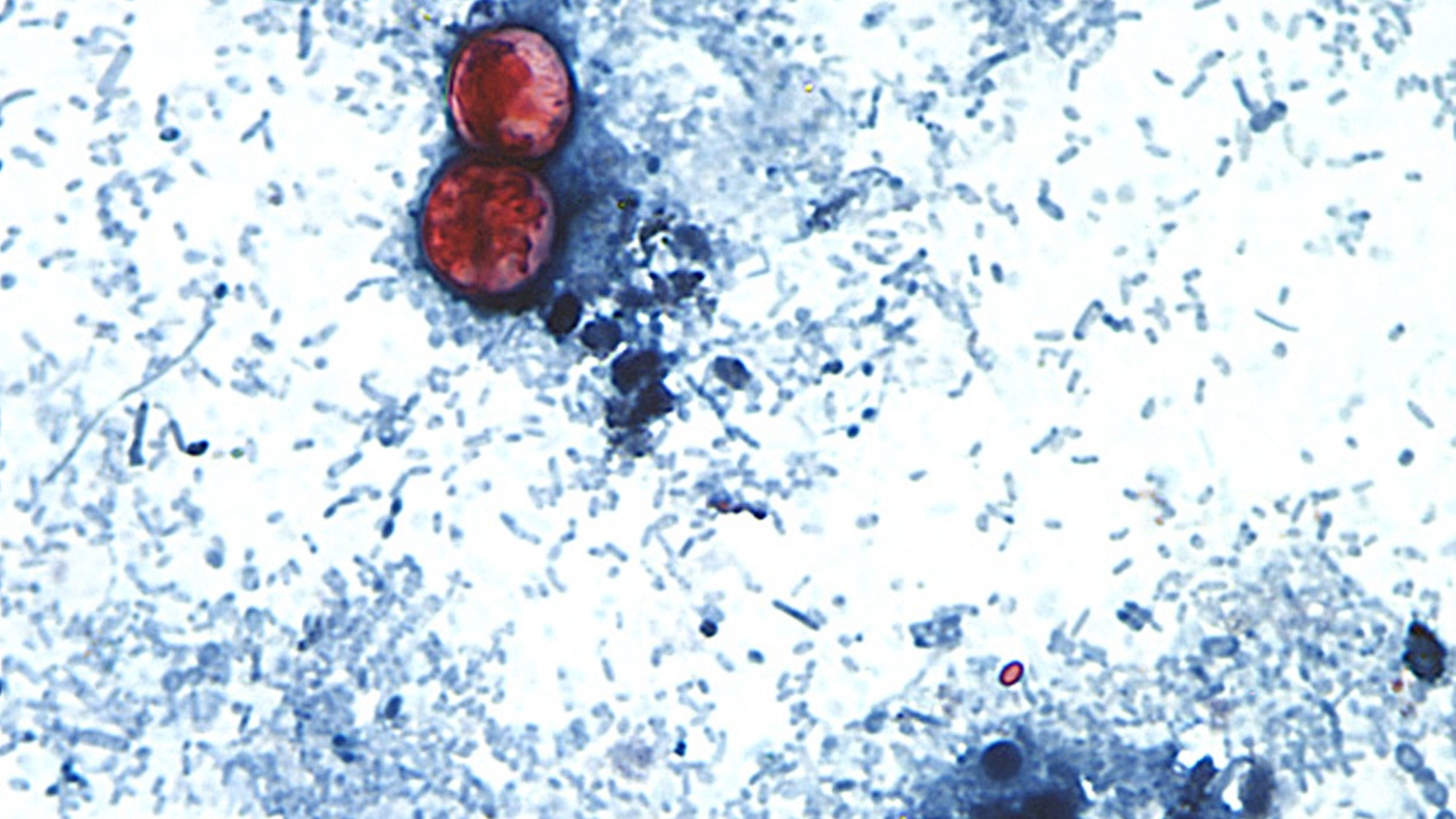 Cyclospora cayetanensis is a unicellular parasite that causes an intestinal infection called cyclosporiasis.