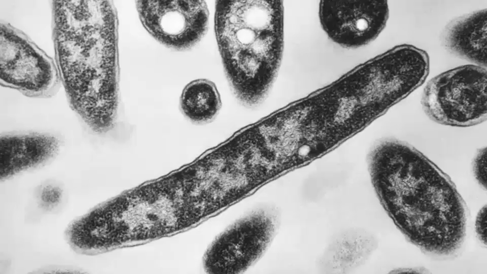 Photo: abc7ny.com NYC Health Commissioner Grilled Over Deadly Upper East Side Legionnaires Outbreak