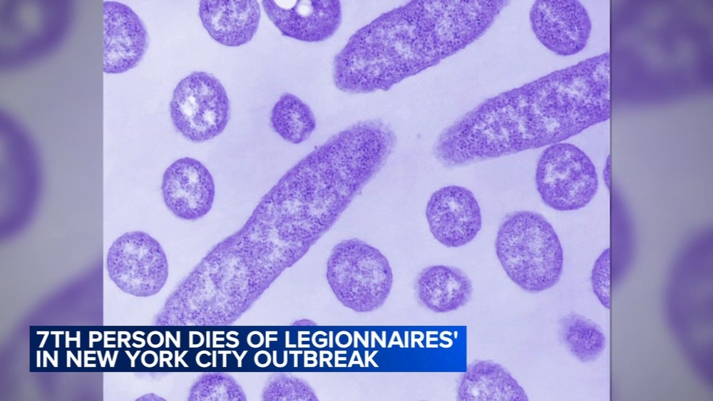 New York City Legionnaires' disease outbreak linked to 7 deaths is declared over