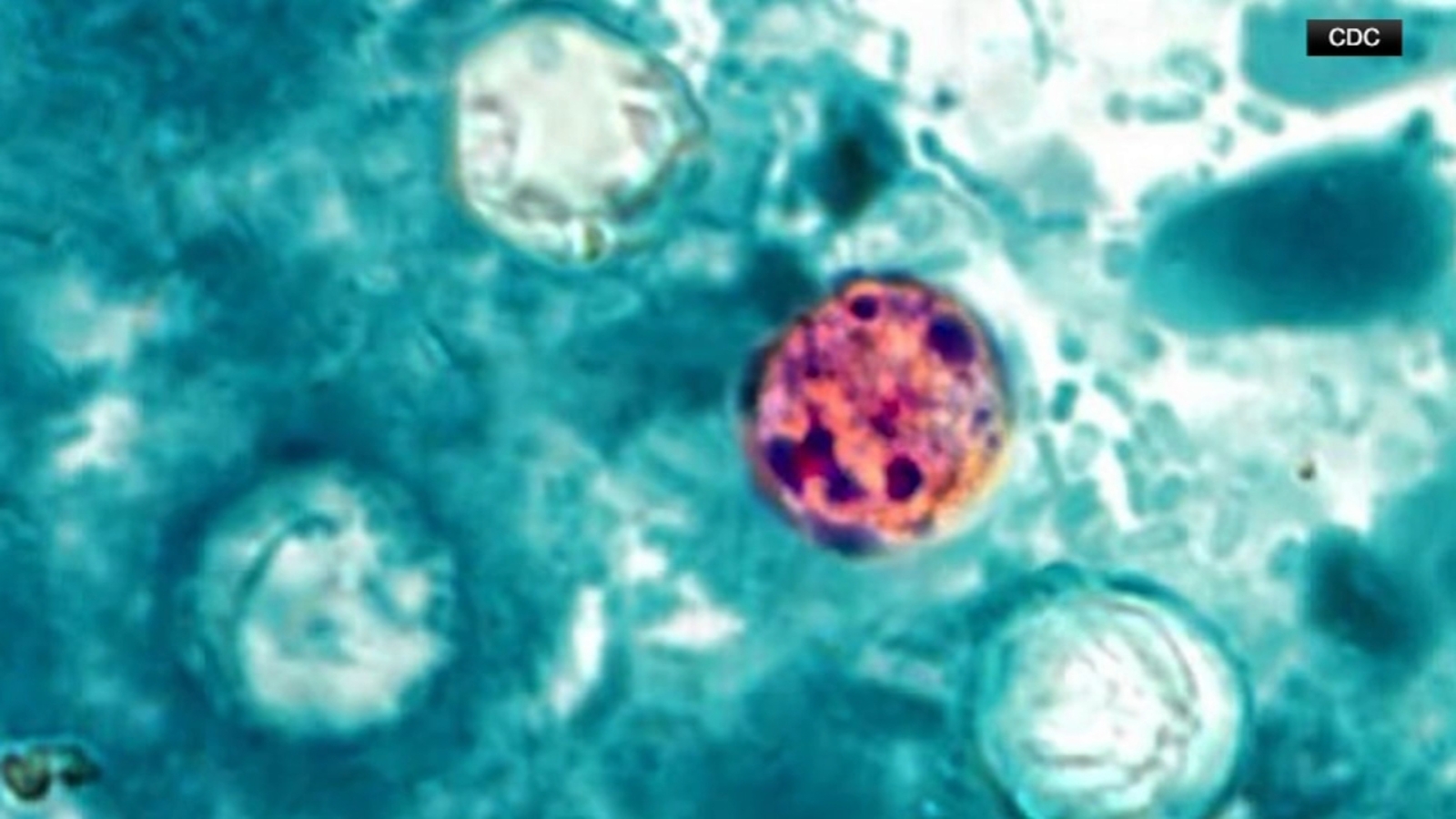 Michigan health officials say people can resume regular lettuce-eating habits as new cases of cyclosporiasis slow