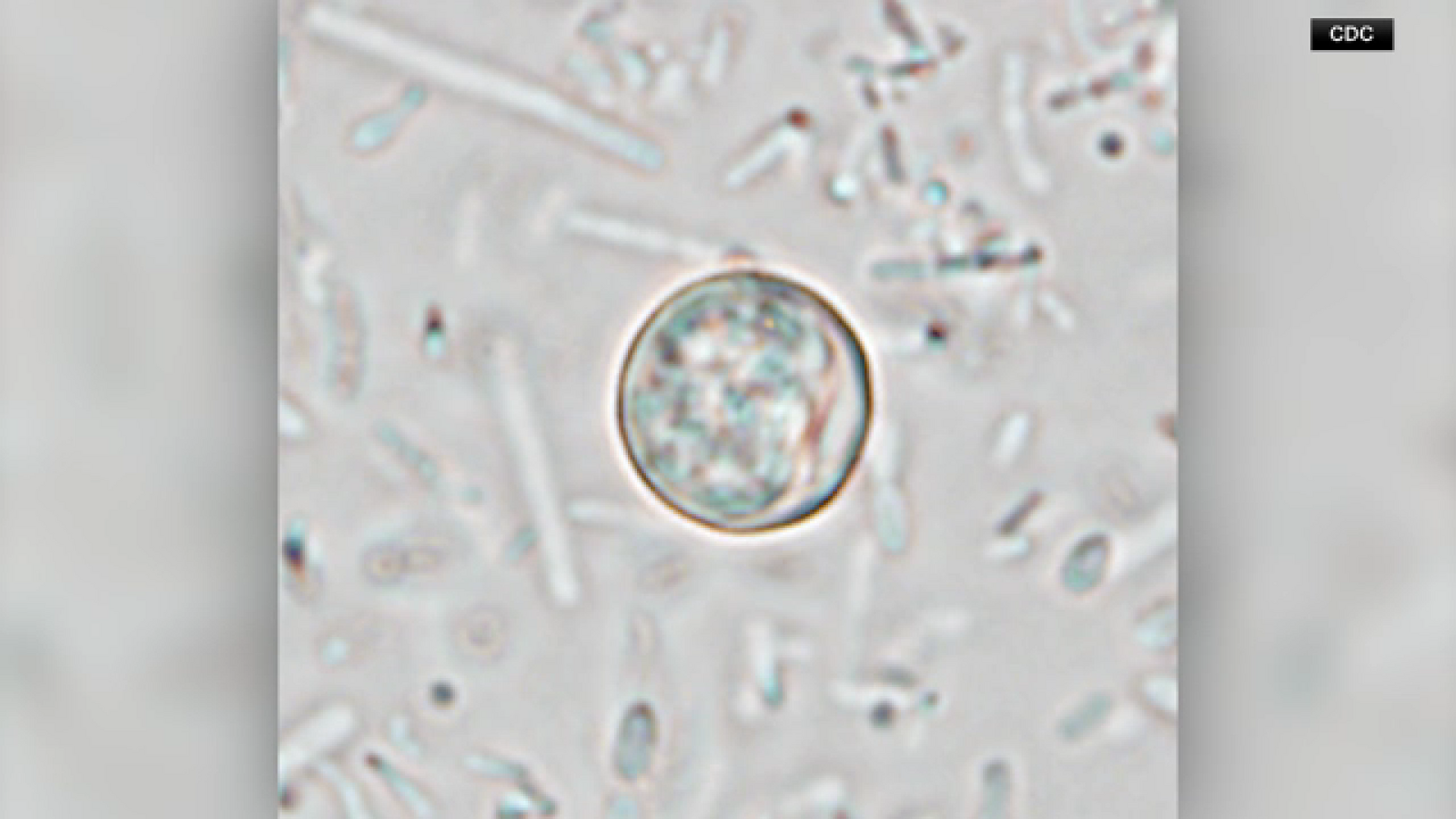 Cyclosporiasis cases at 54 in Harris County; 10 new cases reported in Houston, health officials say