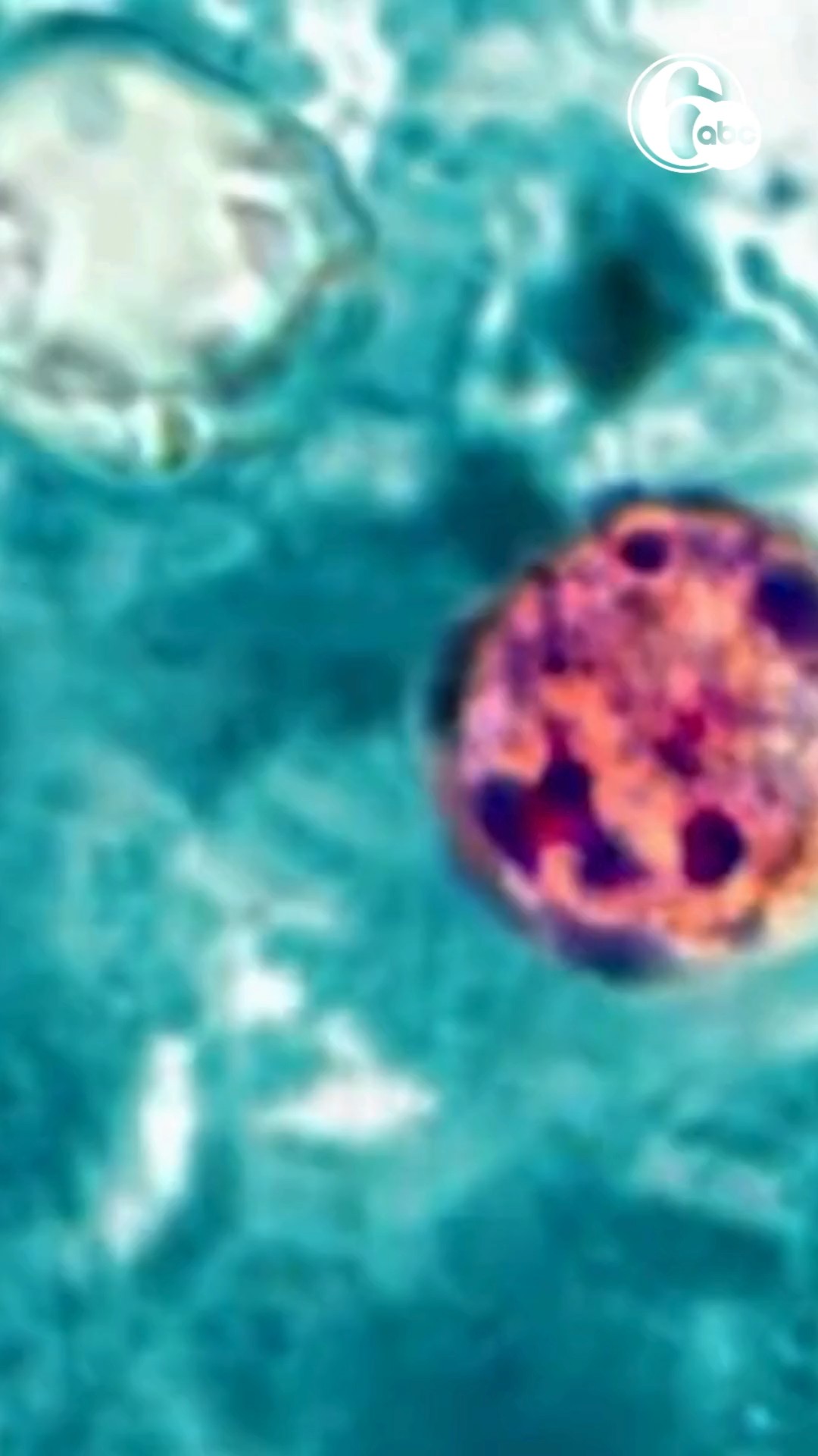 2 deaths reported in cyclosporiasis outbreak in Michigan