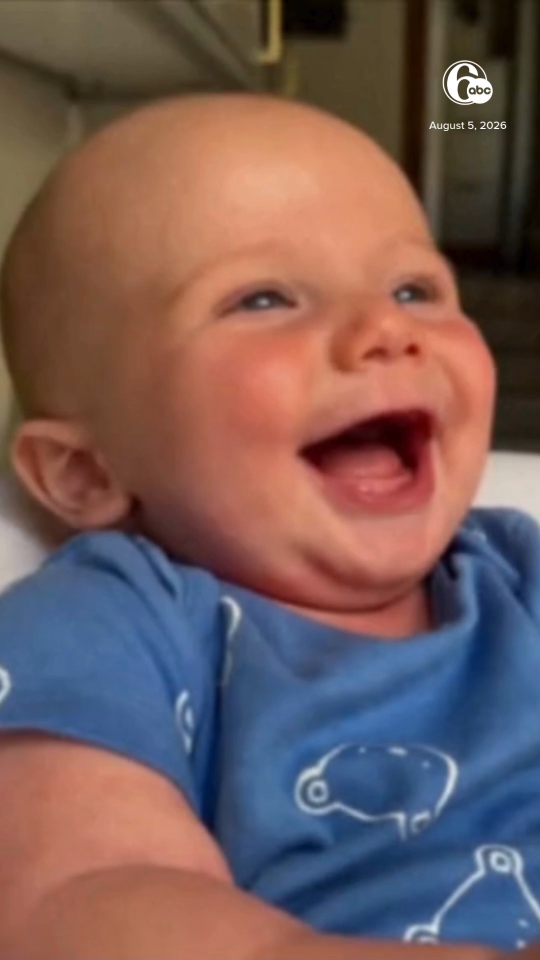Miracle baby headed home after receiving historic in-utero surgery
