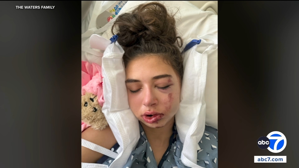 Teen speaks out about e-bike dangers after life-threatening crash