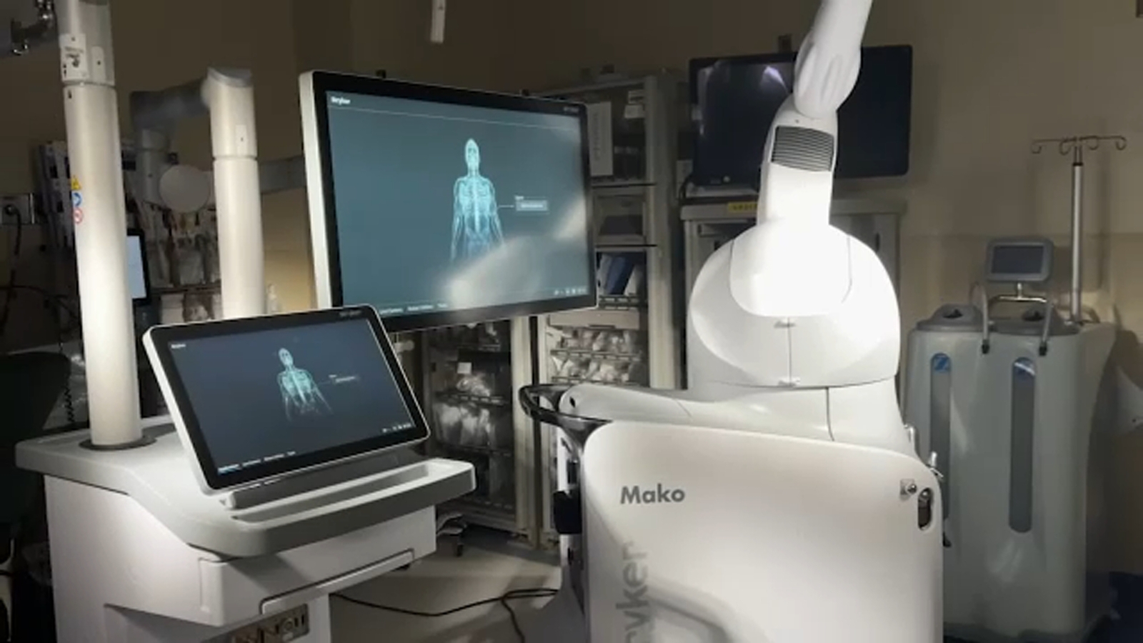 Saint Agnes performs 1st spine surgery in Central Valley using Mako 4 robotic system