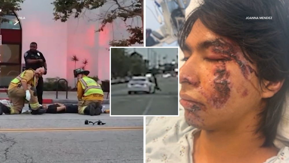 Culver City pedestrian describes being hit by driver fleeing police