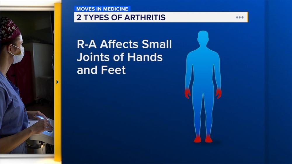 New drugs cut the disability of rheumatoid arthritis | Moves in Medicine