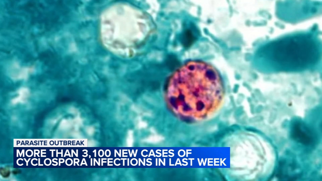 More than 3,100 cyclosporiasis infections reported in last week