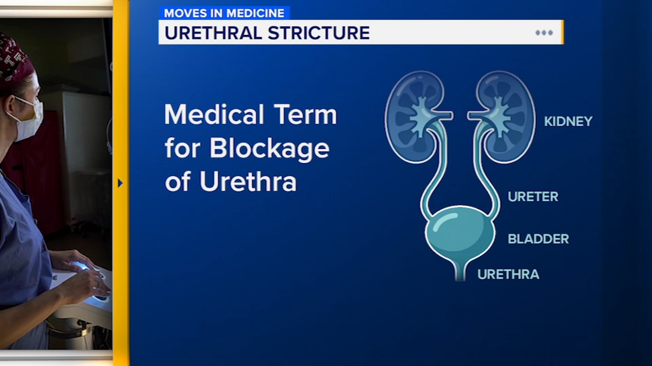 Urethral blockages can be cause for bathroom trips | Moves in Medicine