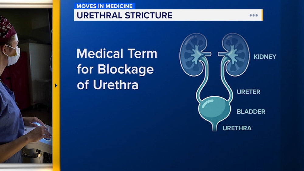 Urethral blockages can be cause for bathroom trips | Moves in Medicine