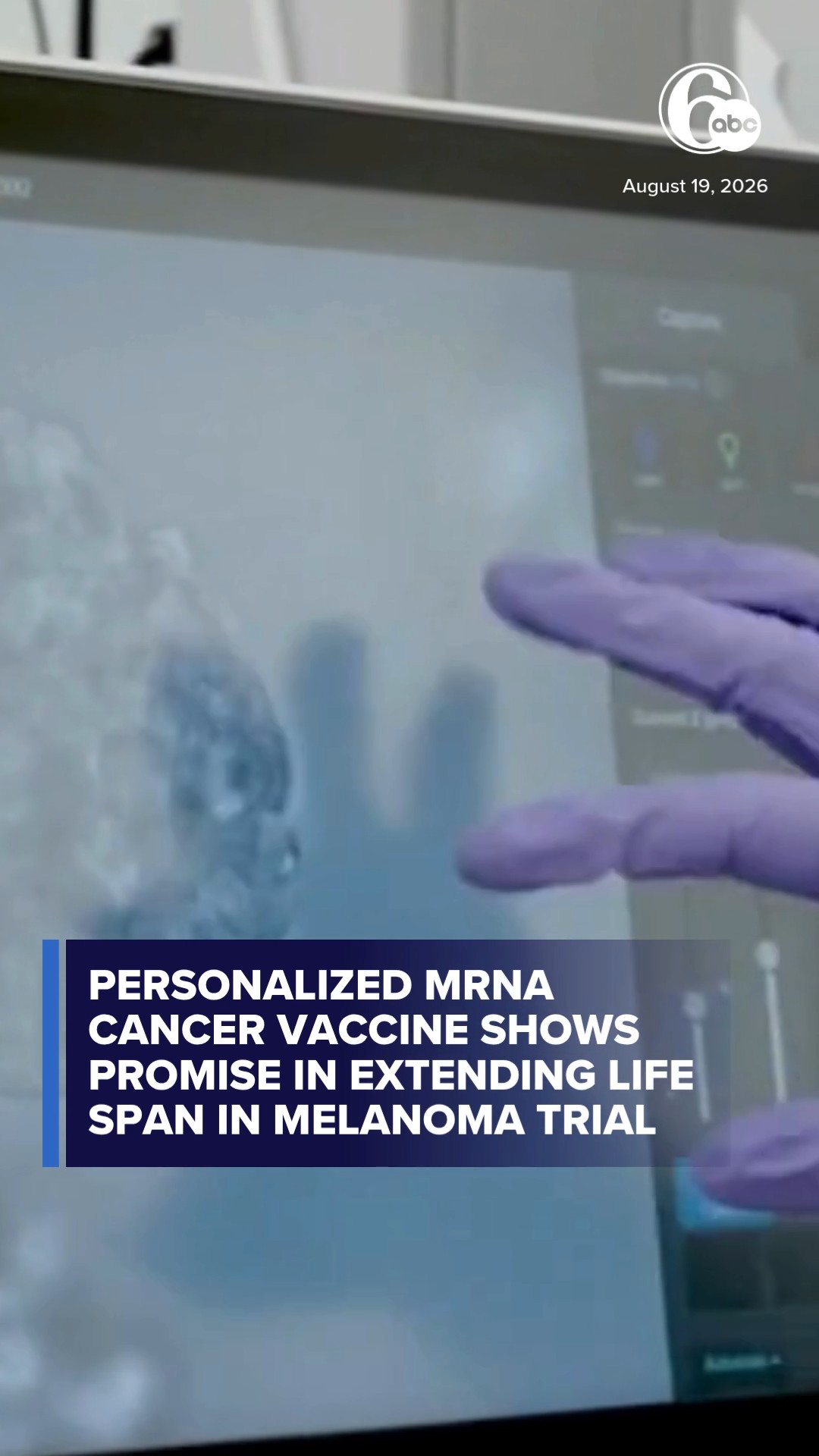 mRNA cancer vaccine shows promise in extending life span