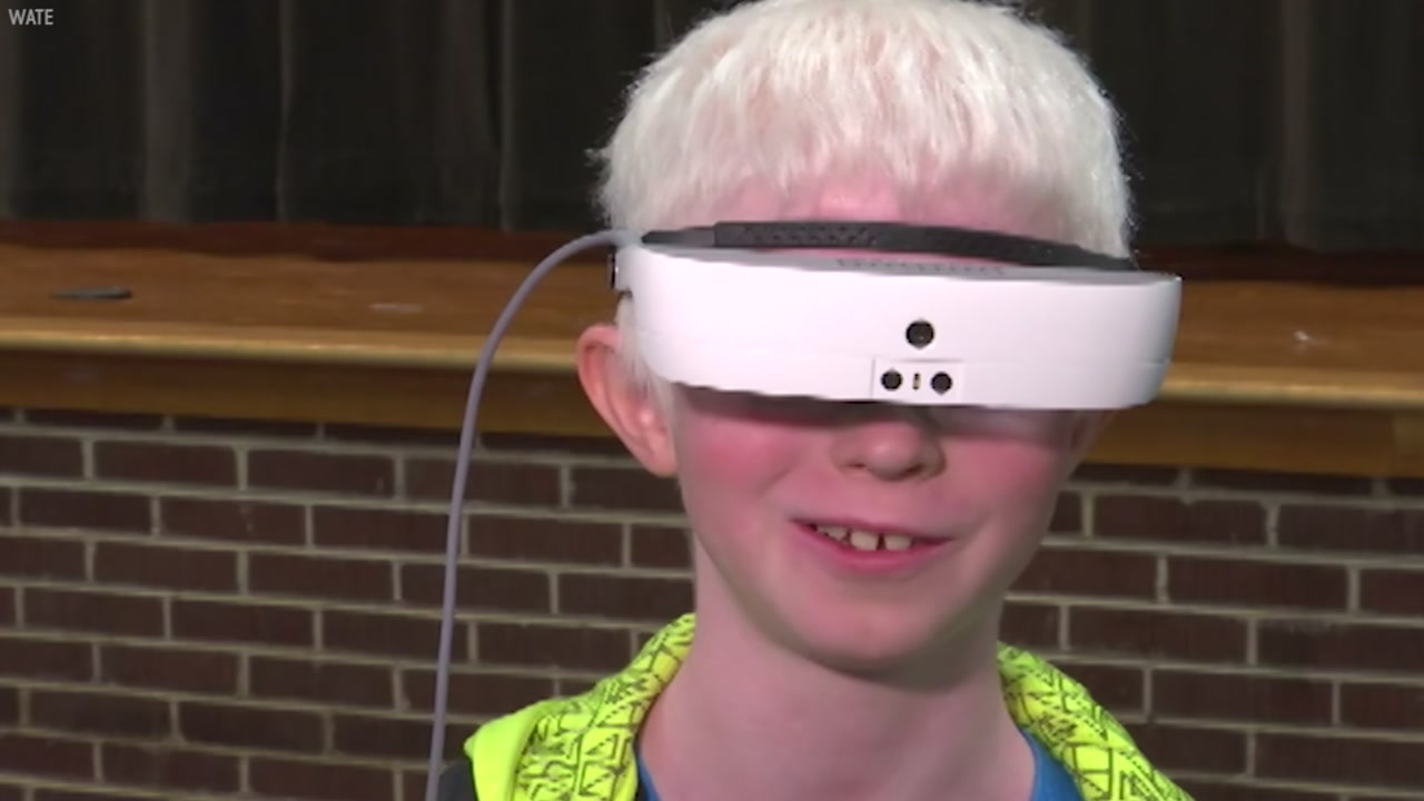 Community raises $10,000 to buy eSight glasses for legally blind boy