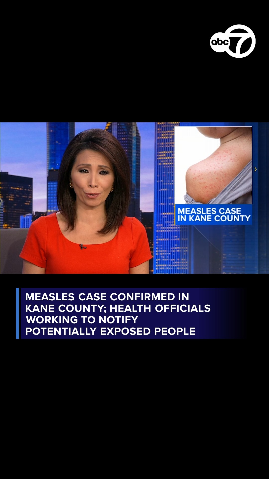 Measles case confirmed in Kane County, health department says
