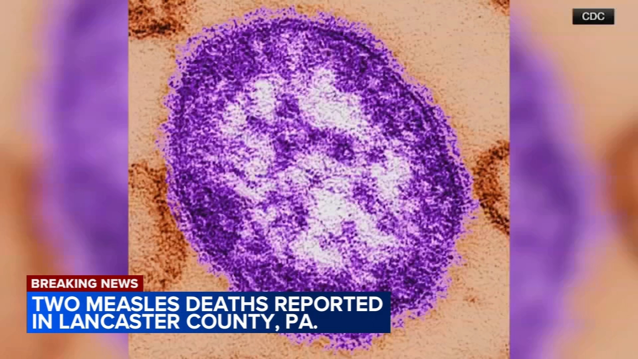 2 unvaccinated people die from measles in Lancaster County, Pennsylvania
