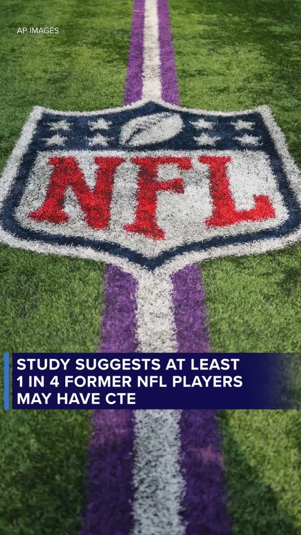Study suggests at least 1 in 4 former NFL players may have CTE