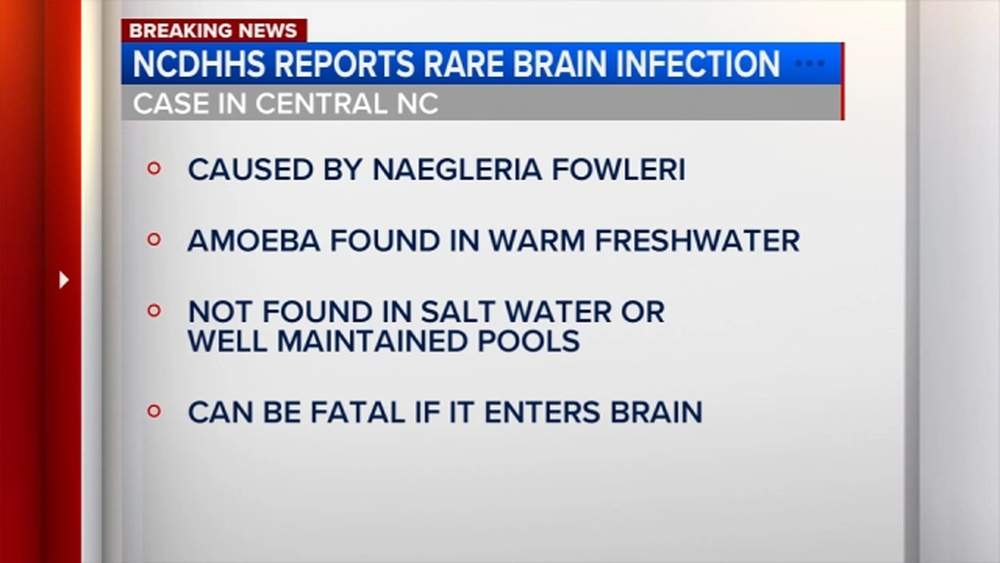 NC health officials report rare amoeba-related brain infection in teen