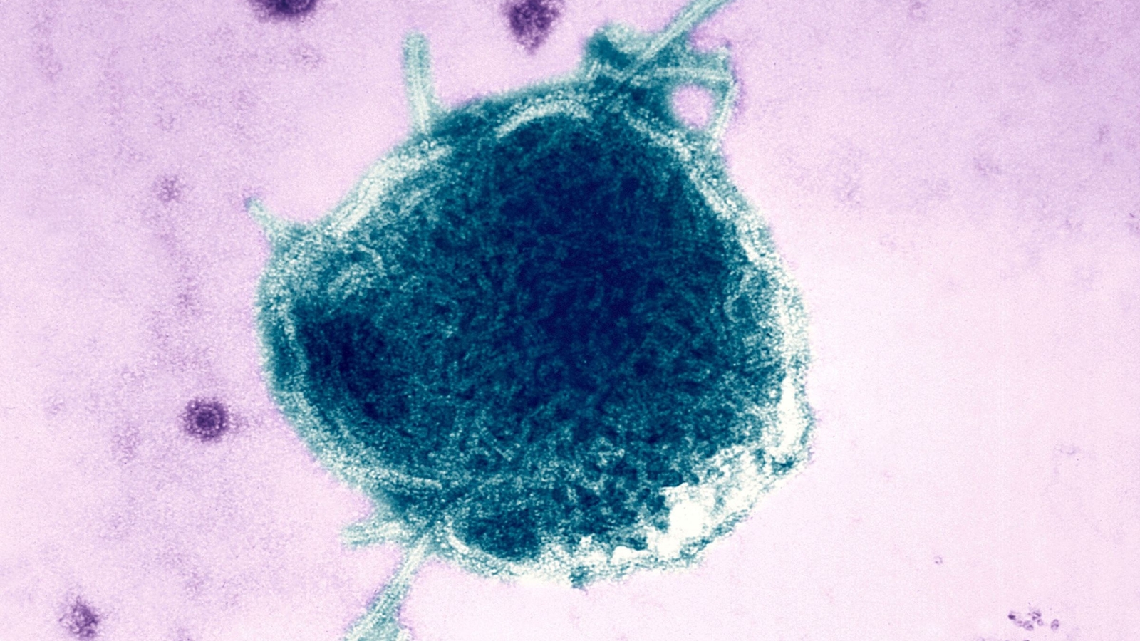 Supported Actor: RFK Jr. Action: Denies Object: Measles Deaths Corrected headline: RFK Denies Measles Deaths