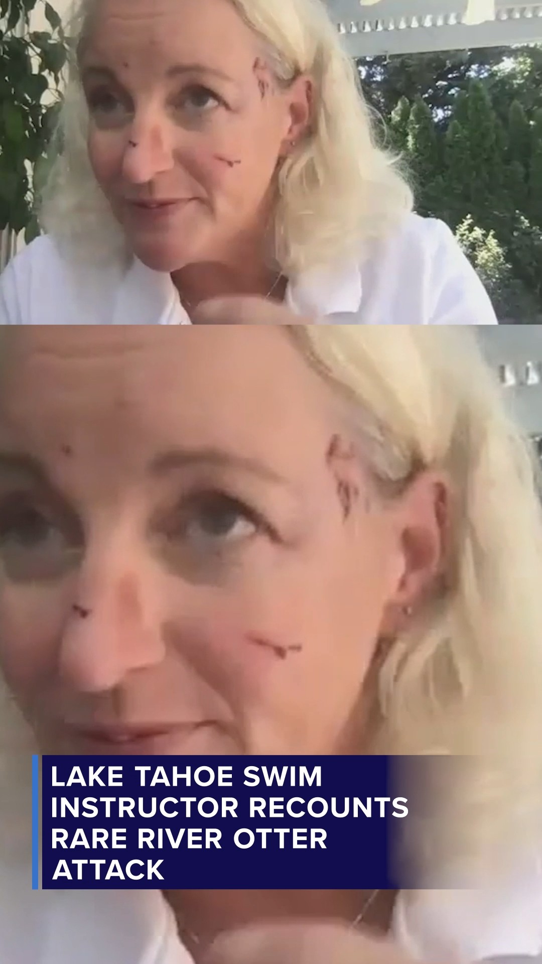 Woman attacked by otter while swimming says 'it felt like a human'