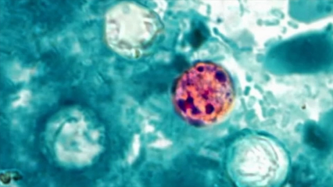 US officials declare end to cyclospora outbreak, but its origin is still unknown