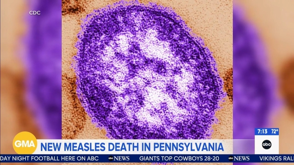 Another measles-related death reported in Pennsylvania