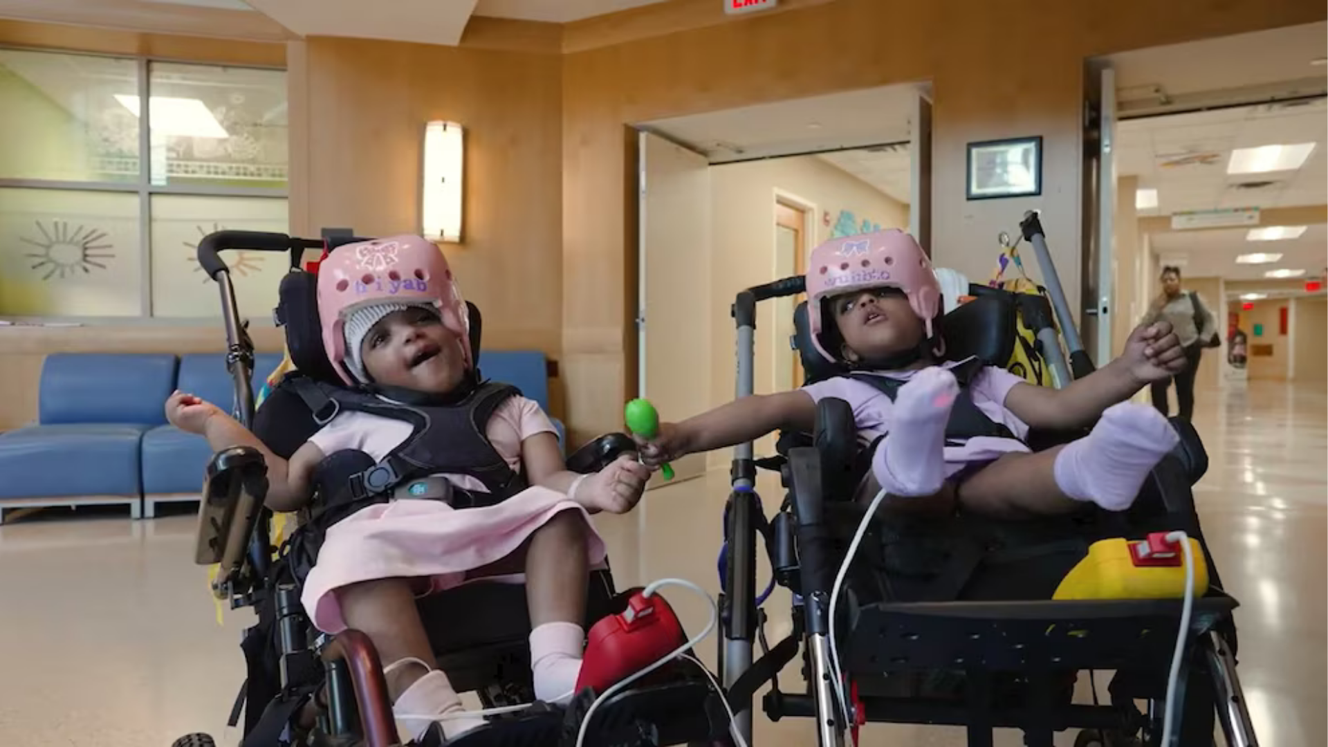 Hiyab and Wuhbto, two-year-old twins who were born conjoined, have undergone successful separation surgery.