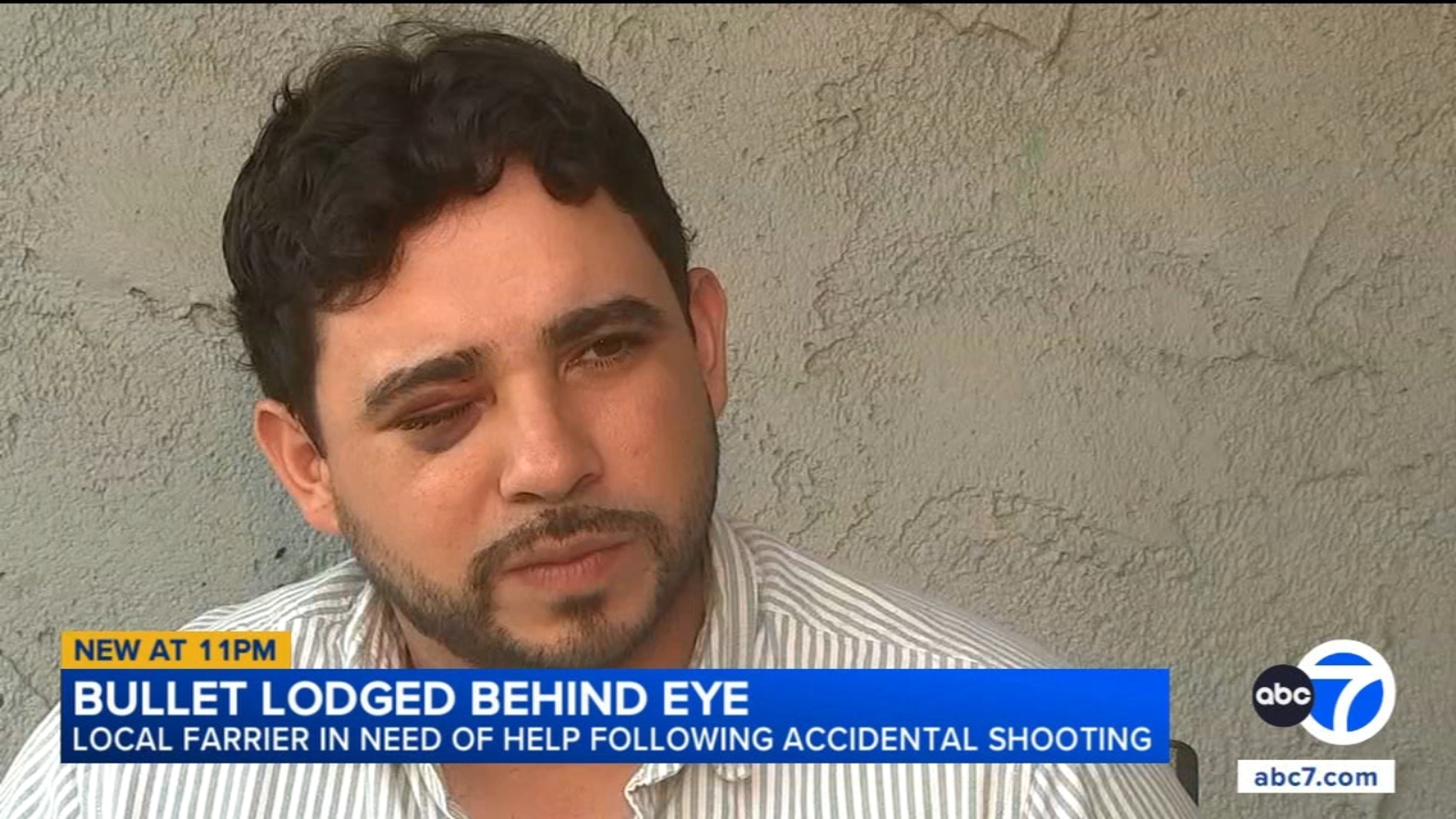 Freak accident leaves man with bullet fragment lodged behind his eye after Chatsworth shooting Freak accident leaves man with bullet fragment lodged behind his eye after Chatsworth shooting