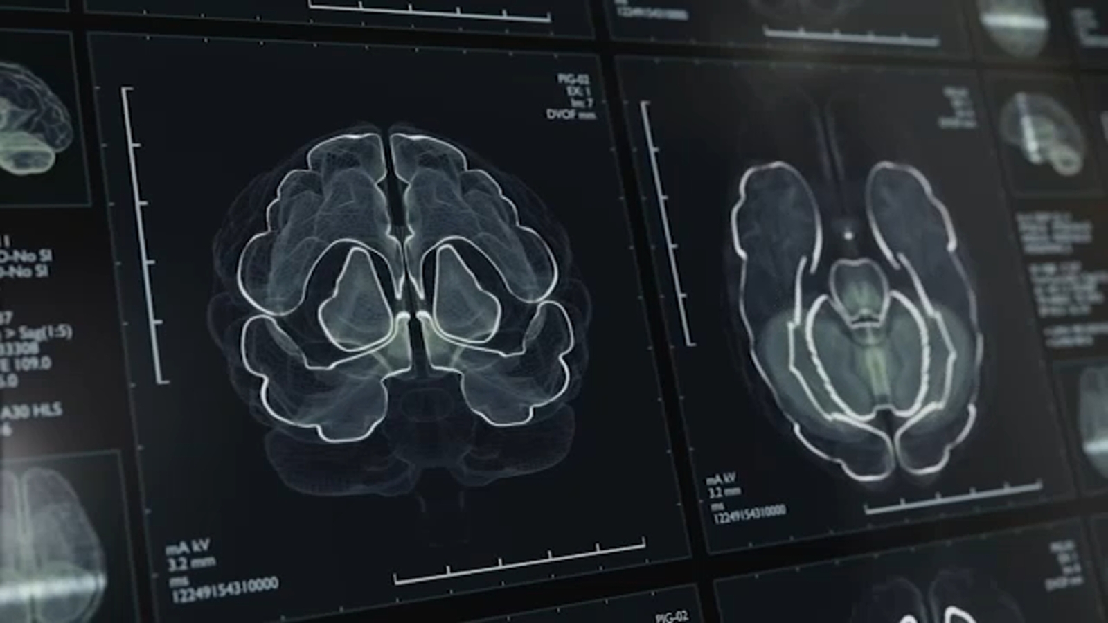 UNC Health's Aging Brain Clinic is a one-stop shop for memory-loss answers