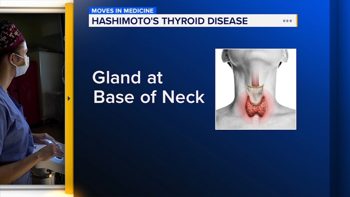 Dr. Kristin Criner Explains Hashimoto's Thyroiditis Diagnosis and Treatment