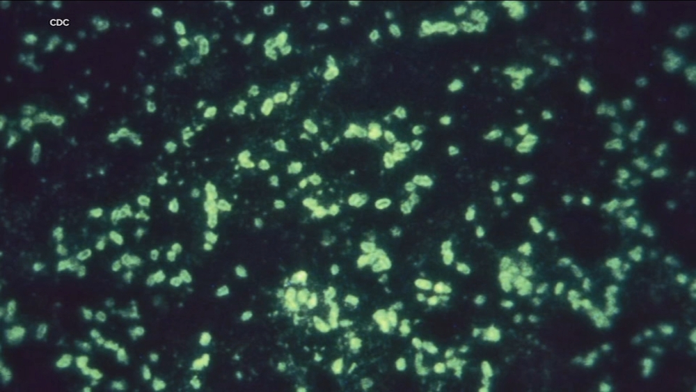 Bay Area experts say there's no need to panic over Siberian plague
