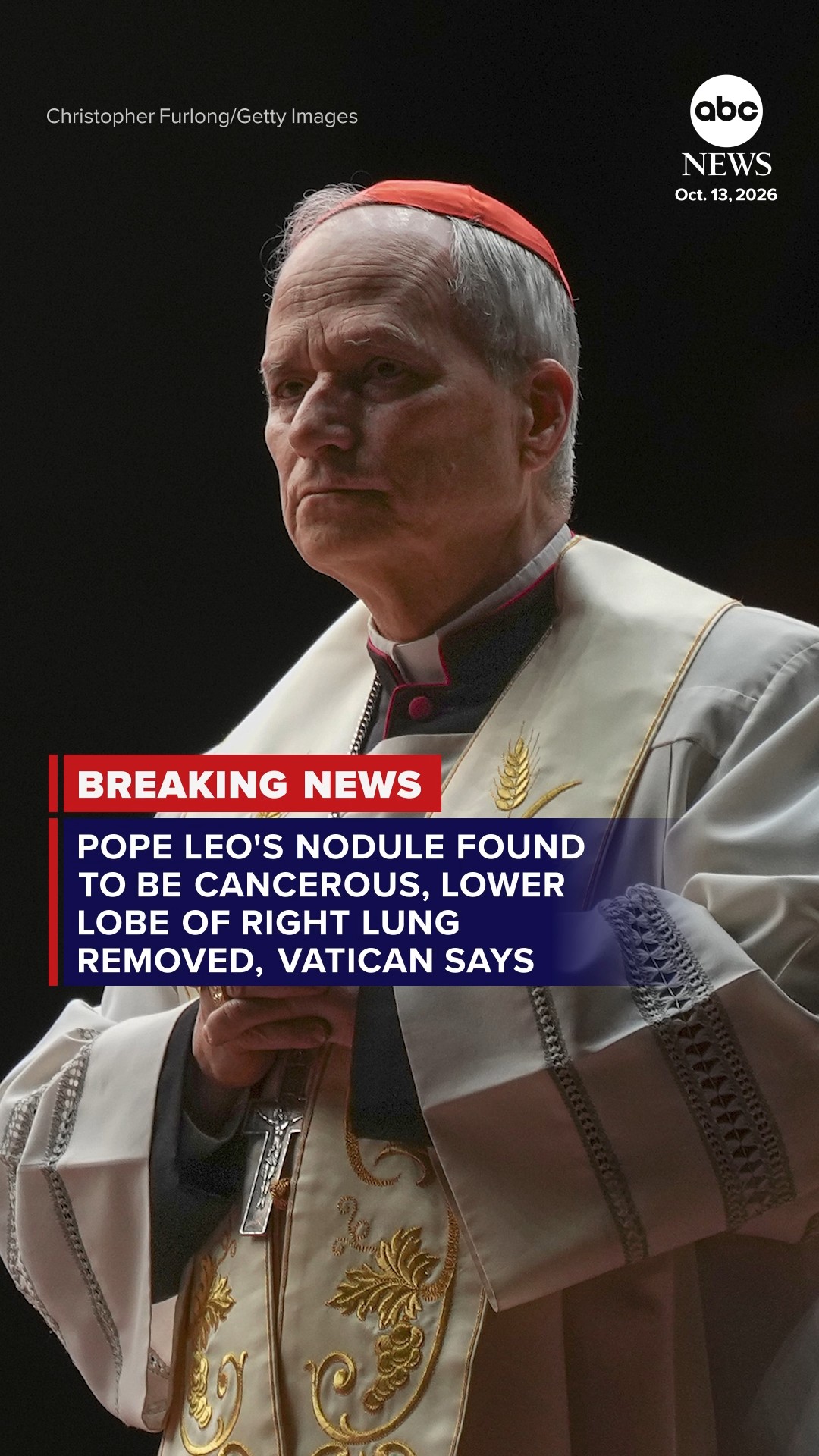 Pope Leo's nodule is cancerous, lower lobe of right lung removed