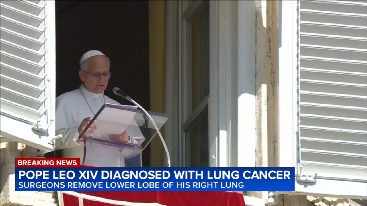 Pope surgery update: Vatican says Pope Leo XIV has lung cancer and the lower lobe of his right lung was removed