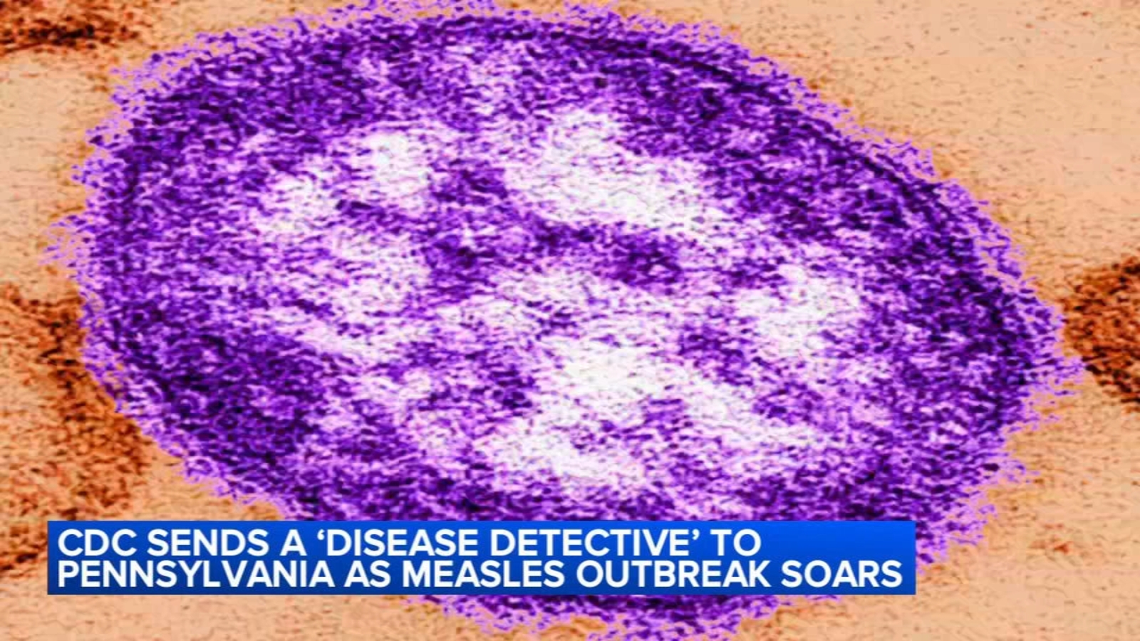 Cdetective CDC to send 'disease detective' to Pennsylvania as measles outbreak ...