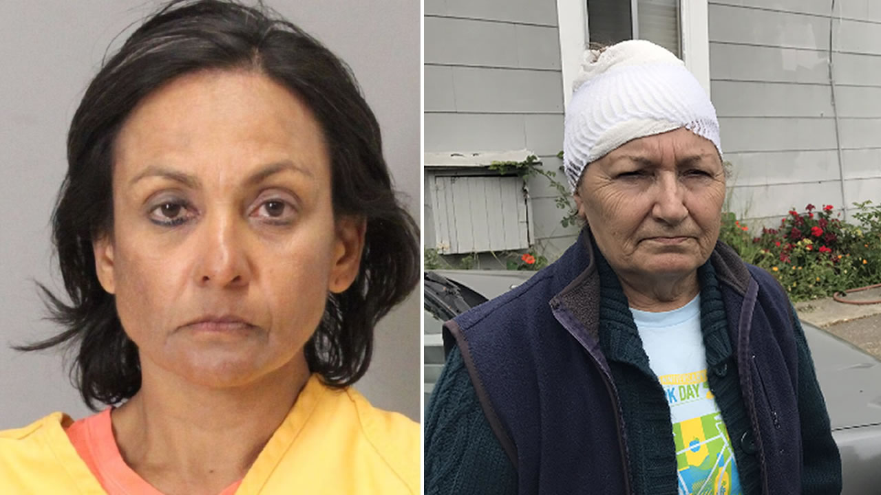 Elderly couple fends off intruder in bloody attack in San Jose