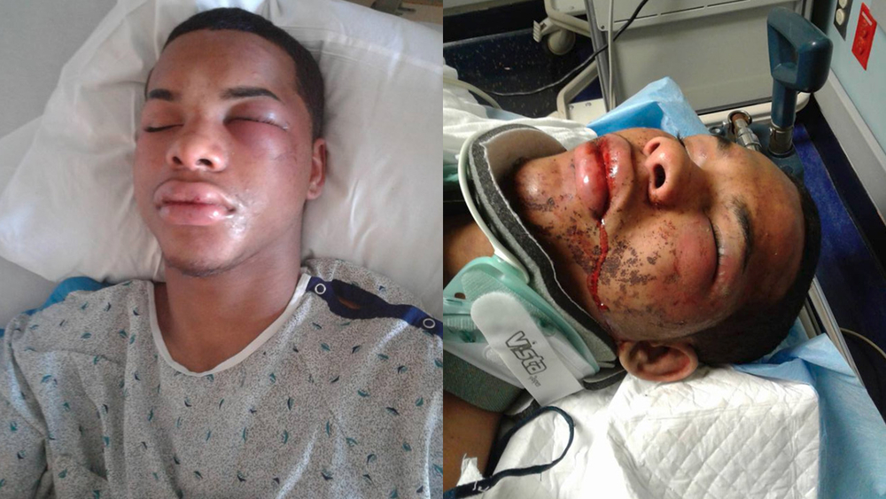 NJ officer charged with assault for allegedly punching teen