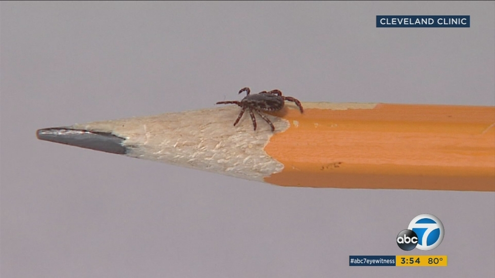 SoCal seeing increase in Lyme disease-carrying ticks