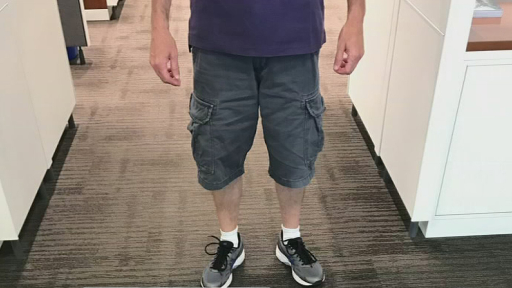 Should men be allowed to wear shorts to the office?