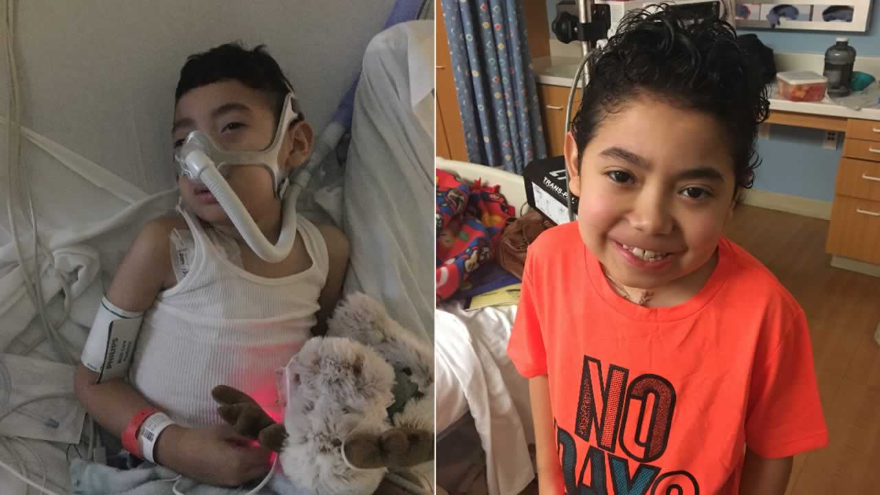 9-year-old recovering from double lung transplant at Stanford