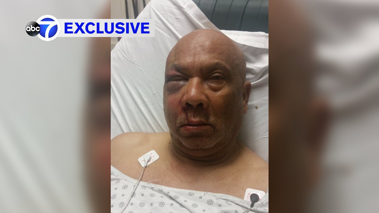 EXCLUSIVE: Paterson bus drivers speak out about vicious attacks