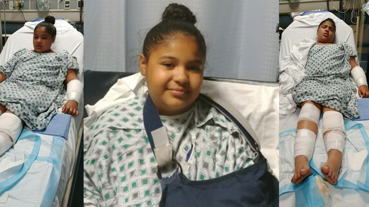 11-year-old Yonkers girl attacked by 2 dogs near bus stop