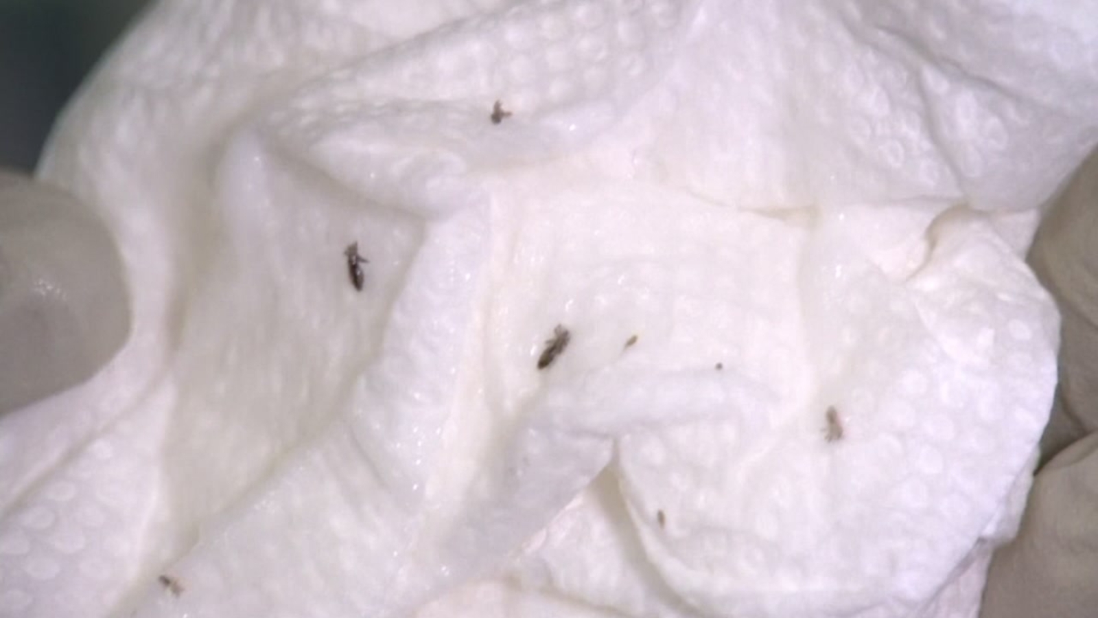 7 on Your Side and Consumer Reports How to remove head lice ABC7 San