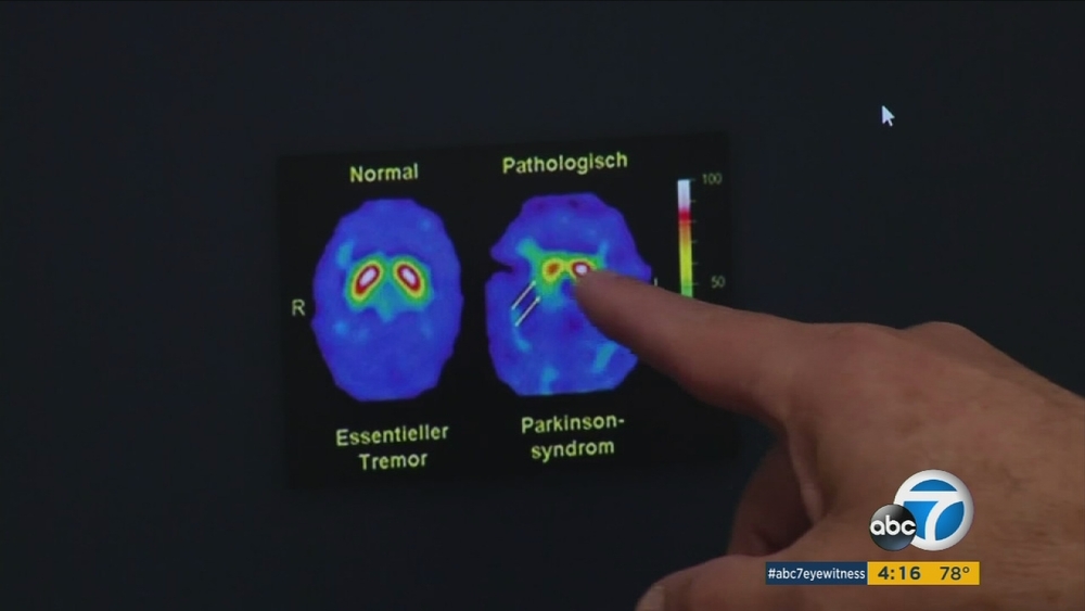 Popular supplement may treat rare sleep disorder 